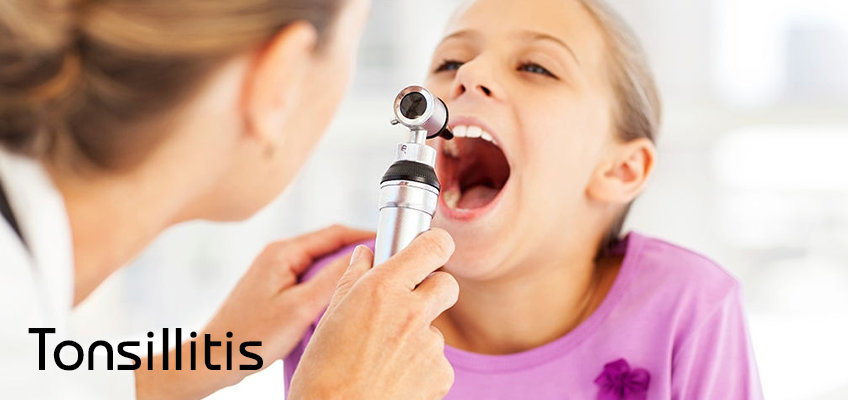 Follicular and chronic tonsillitis treatment, Symptoms, Causes and Surgery