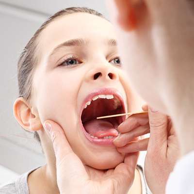 What is Tonsillitis Infection?
